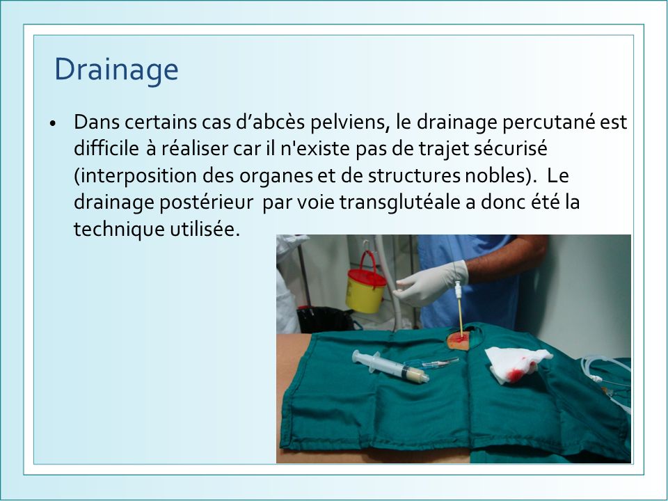 drainage abces prostatique)