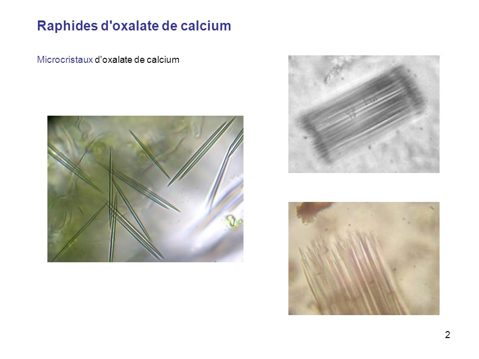 Raphides d oxalate de calcium