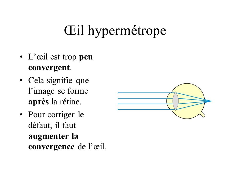 Œil hypermétrope L’œil est trop peu convergent.
