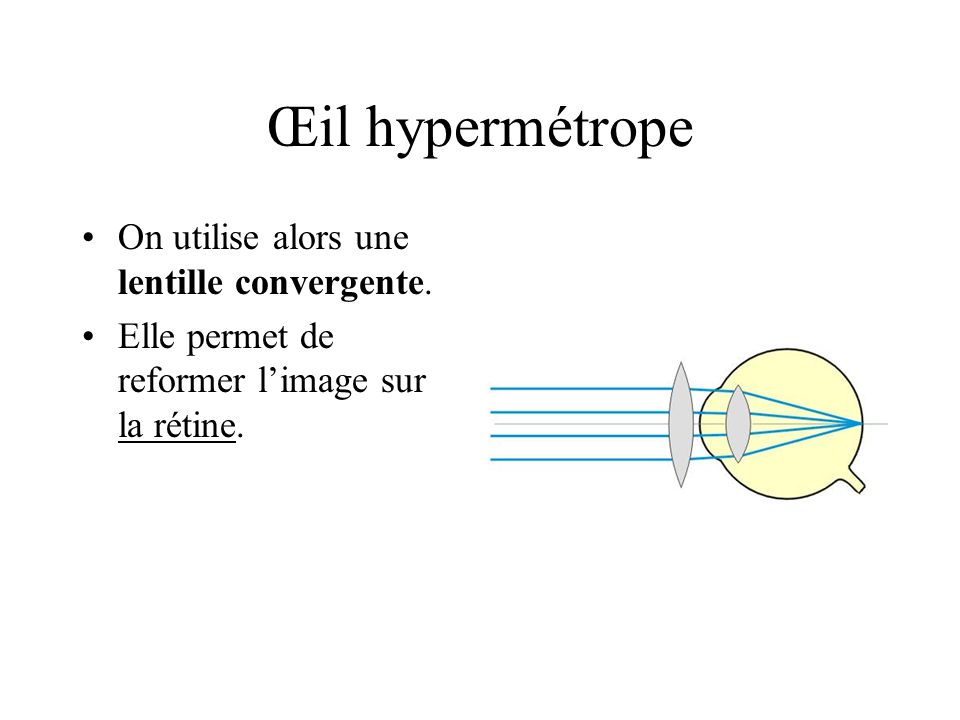 Œil hypermétrope On utilise alors une lentille convergente.