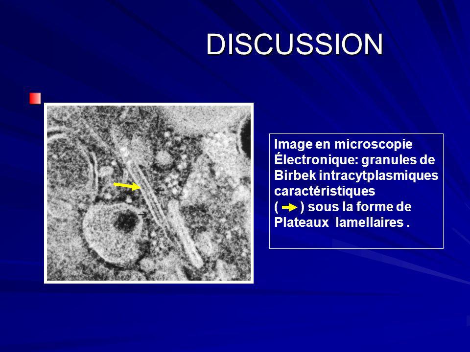 DISCUSSION Image en microscopie Électronique: granules de