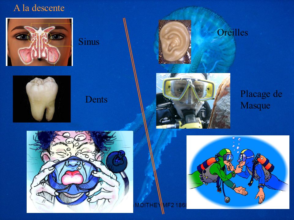 Les accident et anatomie en plongée sous marine à la descente 