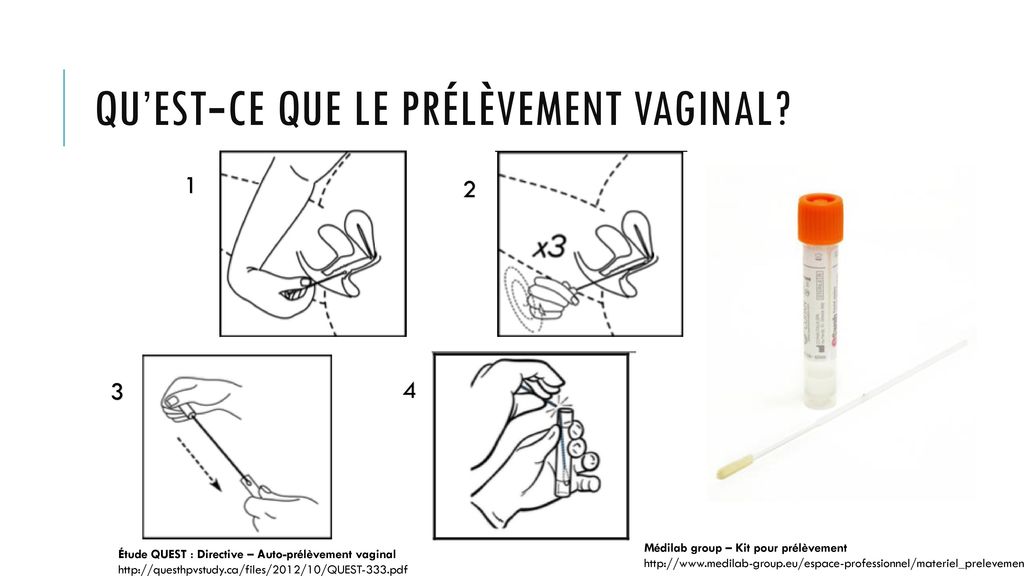 Quel Est Le Meilleur Moyen De D Pistage De La Chlamydia Lauto