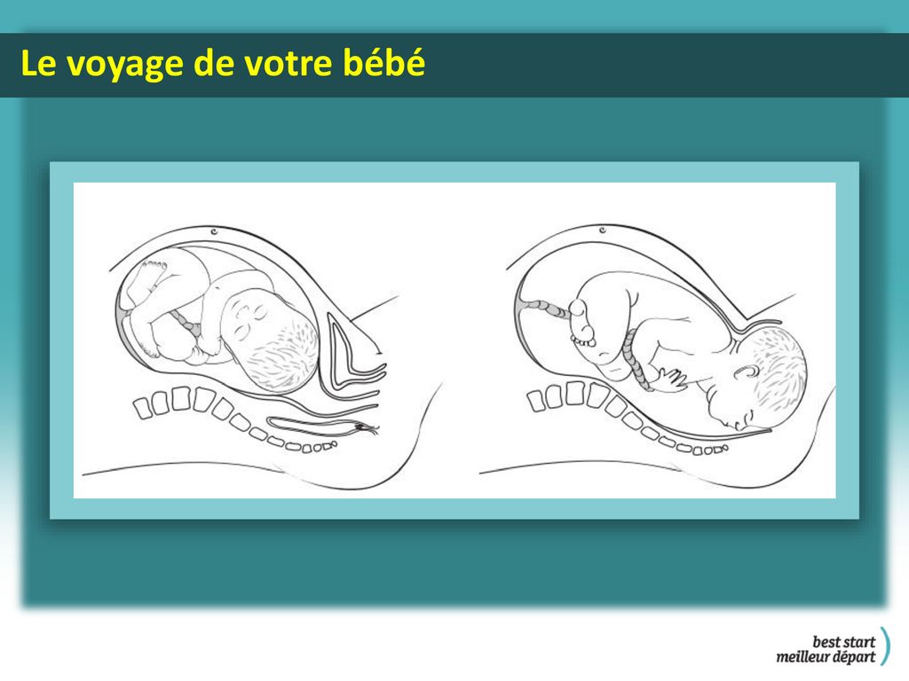 Stades Du Travail Remarque Veuillez Vous Reporter Au Sommaire Du Module Ou Vous Trouverez Le But Les Objectifs Et Le Deroulement Du Module Le Materiel Ppt Telecharger