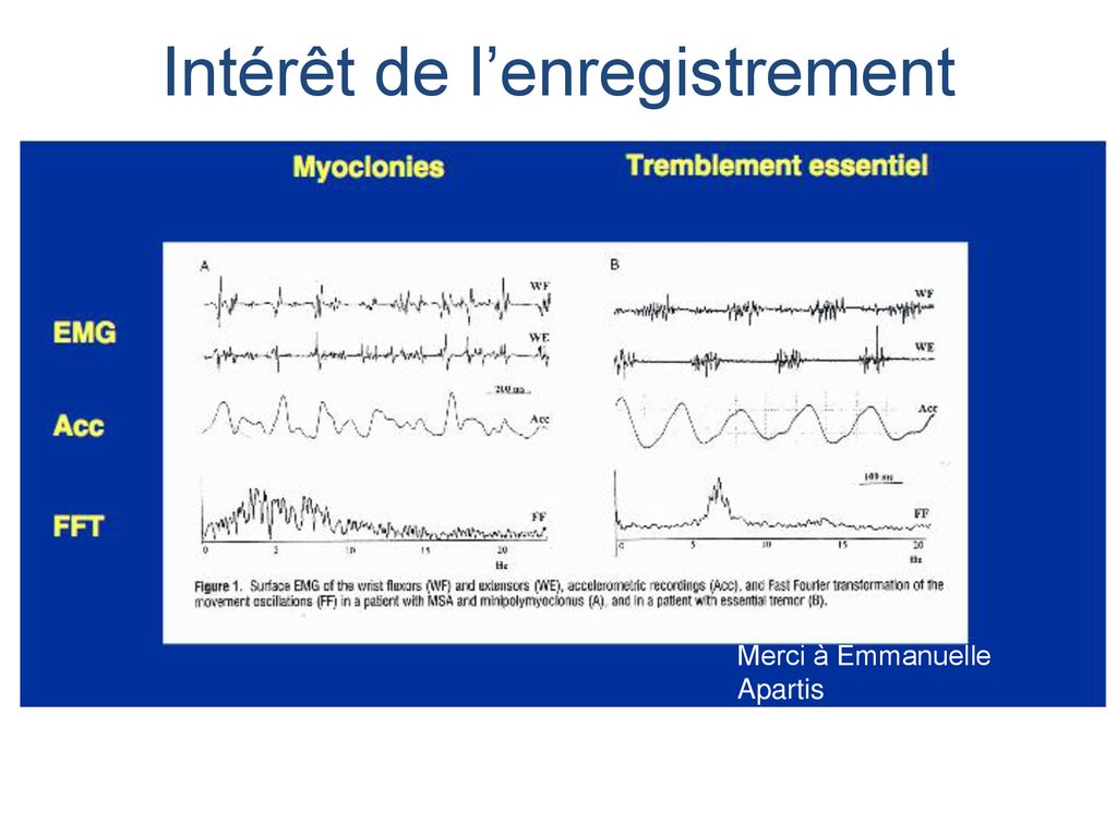 Mouvements Anormaux Et (en) Réanimation Ppt Télécharger