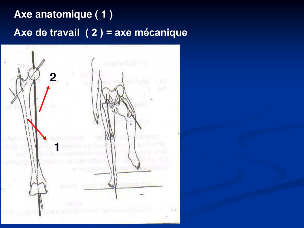 Axe anatomique ( 1 ) Axe de travail ( 2 ) = axe mécanique 2 1