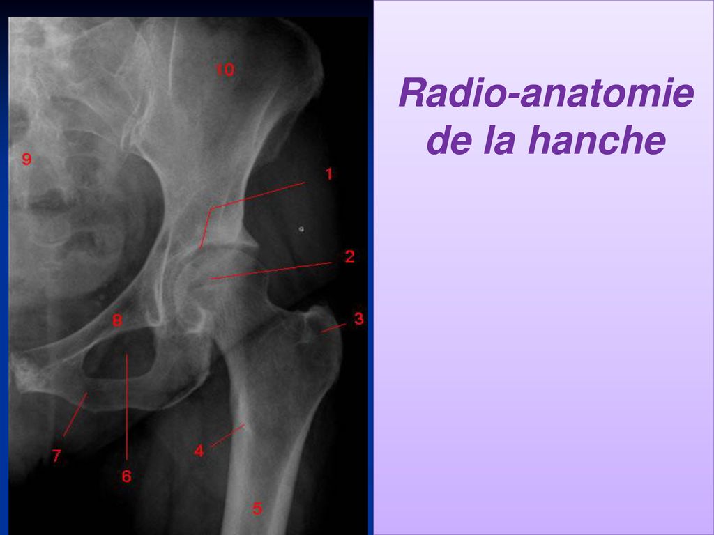 Radio-anatomie de la hanche