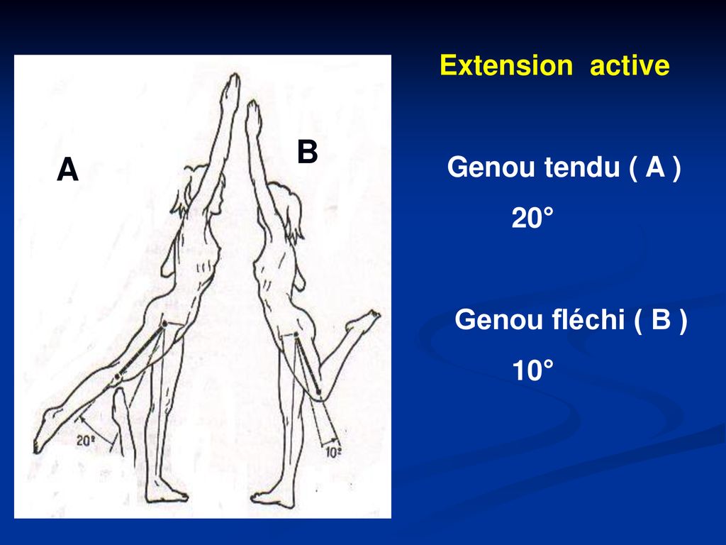 Extension active Genou tendu ( A ) 20° Genou fléchi ( B ) 10° B B A