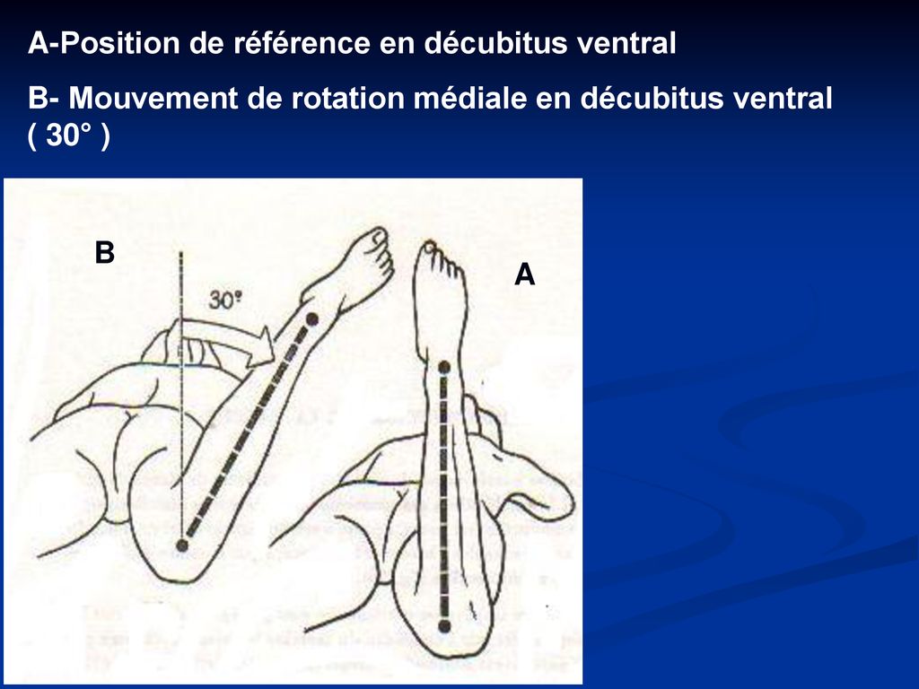 A-Position de référence en décubitus ventral