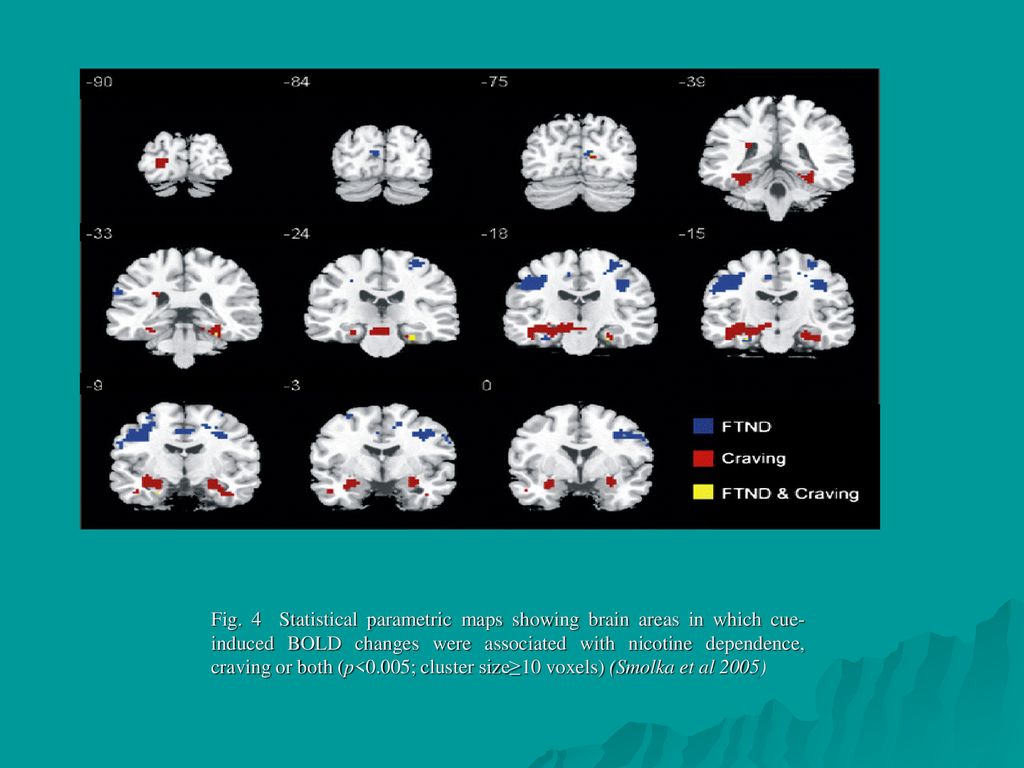 Fig. 4 Statistical parametric maps showing brain areas in which cue-induced BOLD changes were associated with nicotine dependence, craving or both (p<0.005; cluster size≥10 voxels) (Smolka et al 2005)