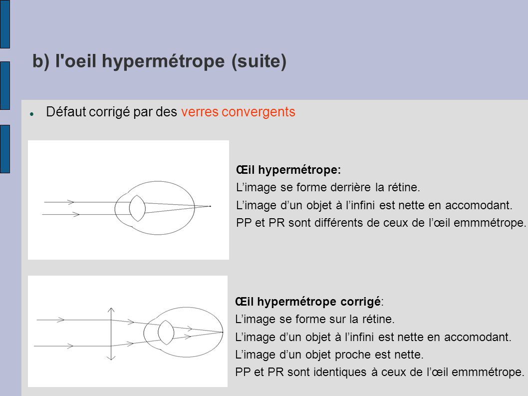 b) l oeil hypermétrope (suite)‏