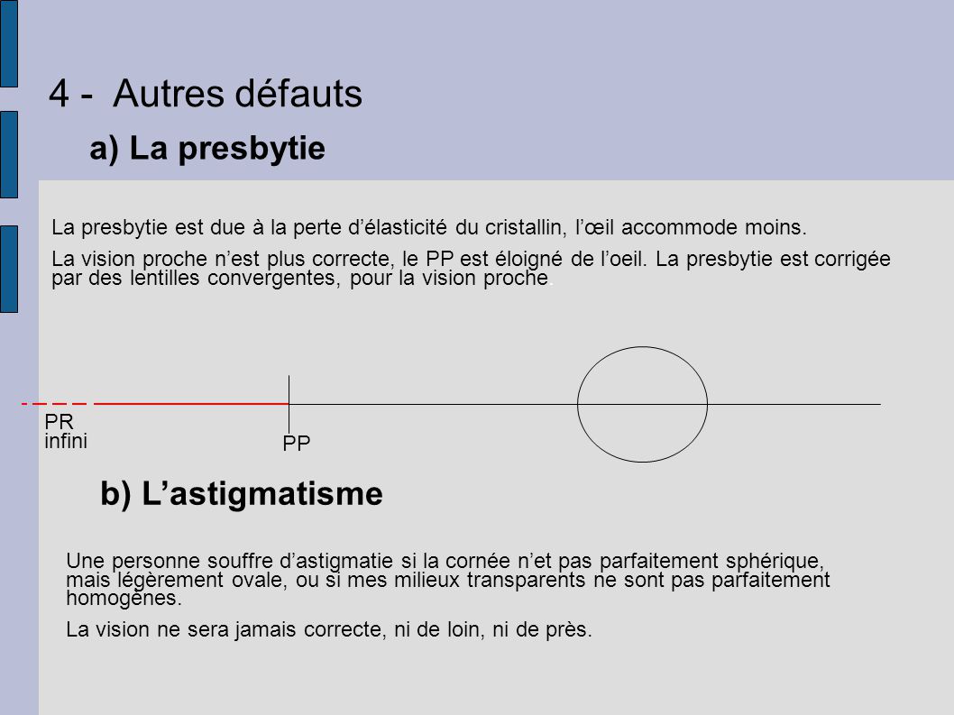 4 - Autres défauts a) La presbytie b) L’astigmatisme