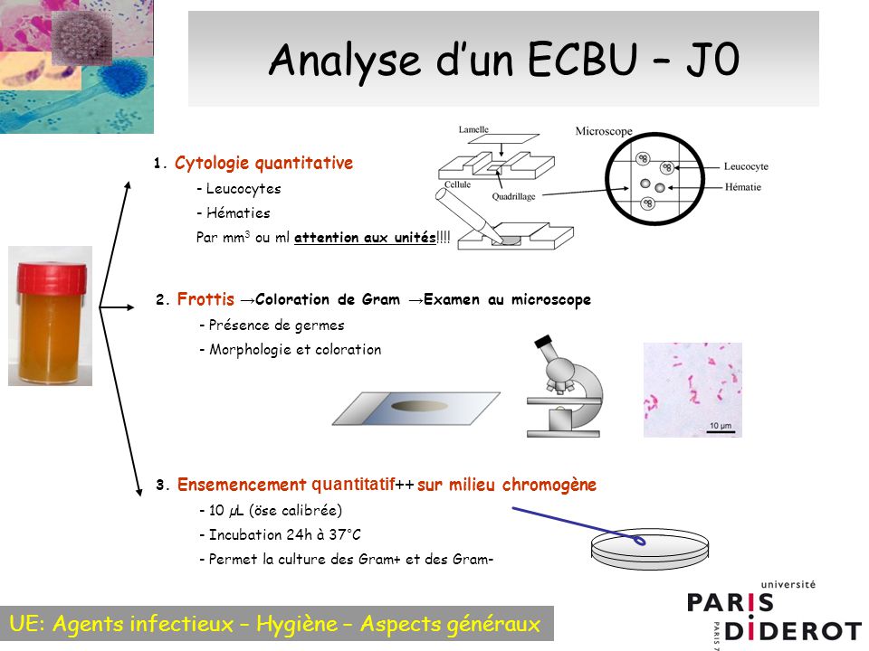Diagnostic bactériologique des infections urinaires ECBU - ppt ...