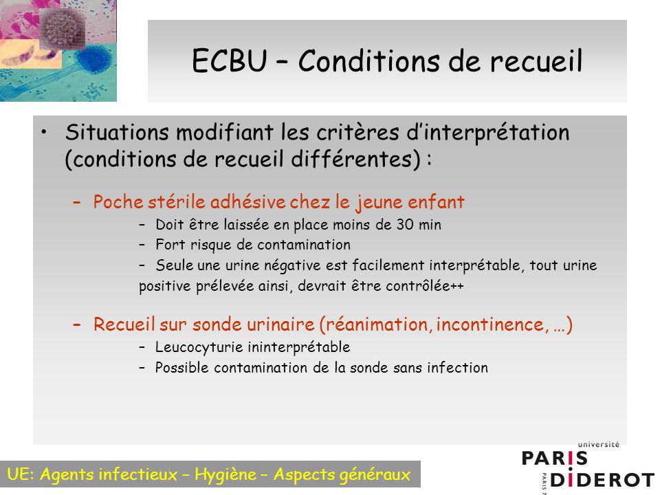 Diagnostic bactériologique des infections urinaires ECBU - ppt ...