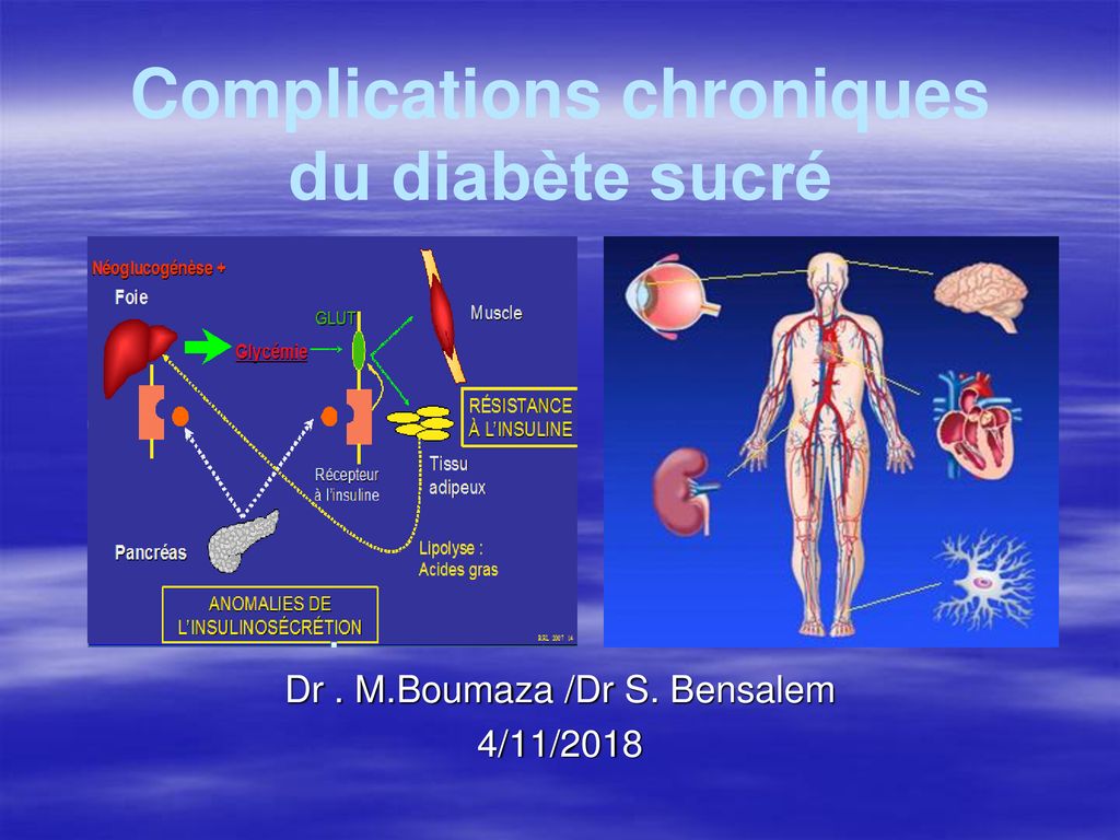 Complications Chroniques Du Diabète Sucré - Ppt Télécharger