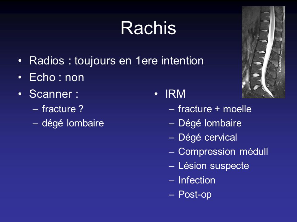 Rachis Radios : toujours en 1ere intention Echo : non Scanner : IRM