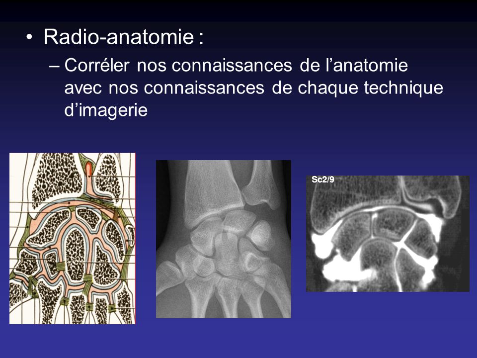 Radio-anatomie : Corréler nos connaissances de l’anatomie avec nos connaissances de chaque technique d’imagerie.