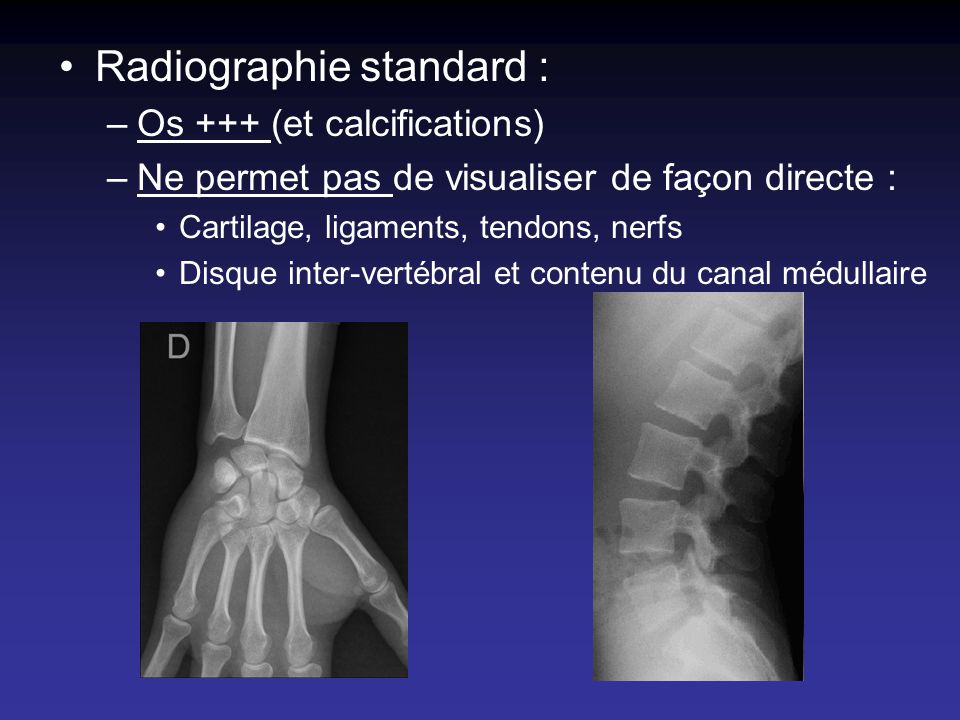 Radiographie standard :
