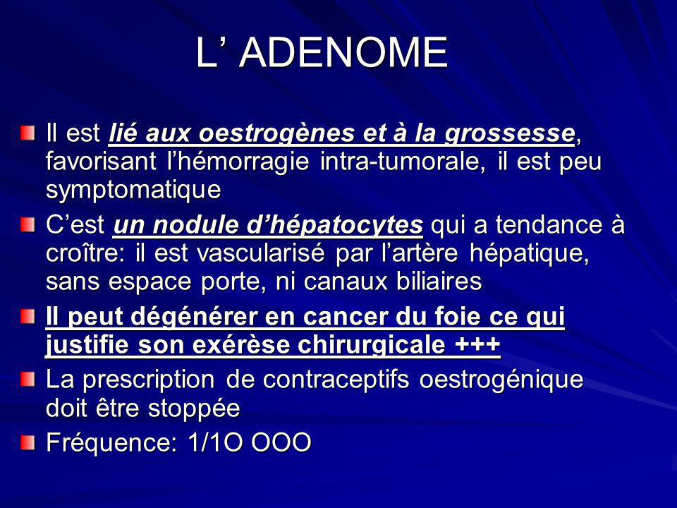 L’ ADENOME Il est lié aux oestrogènes et à la grossesse, favorisant l’hémorragie intra-tumorale, il est peu symptomatique.