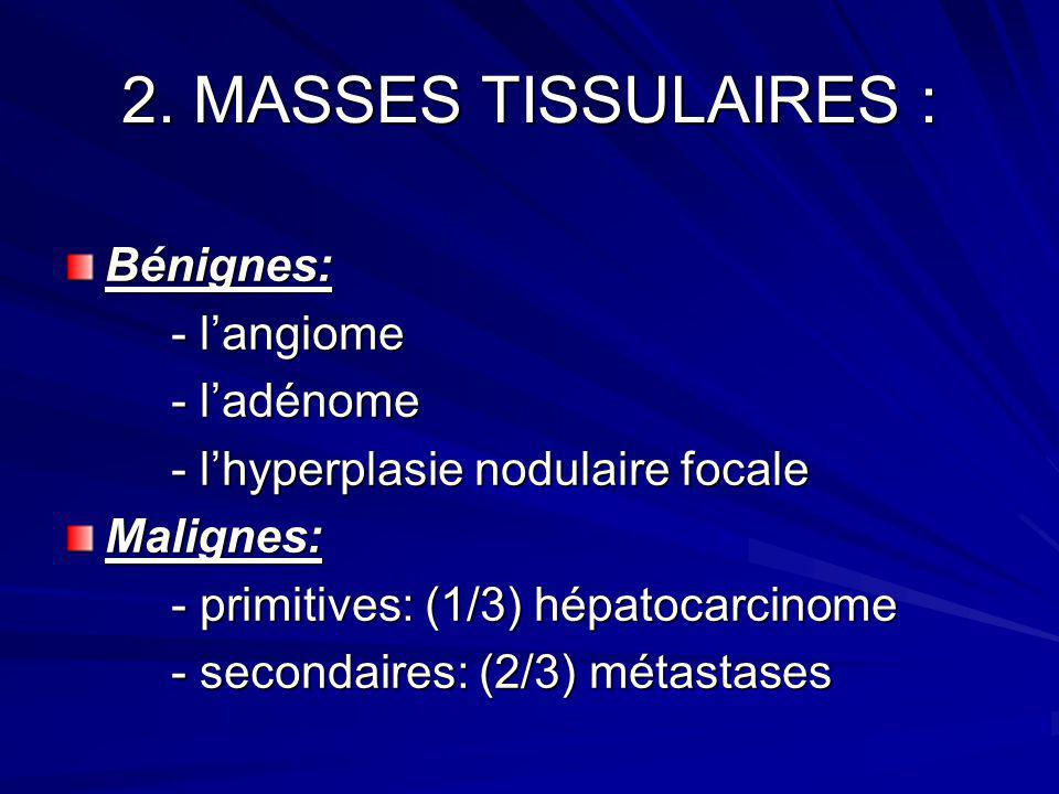 2. MASSES TISSULAIRES : Bénignes: - l’angiome - l’adénome
