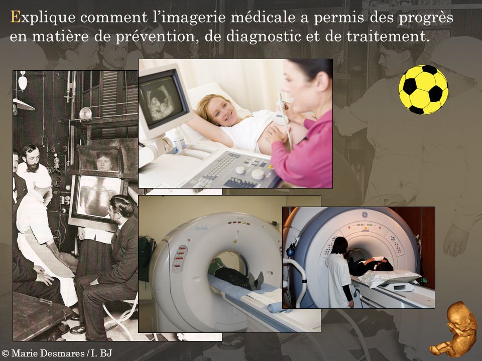 Explique comment l’imagerie médicale a permis des progrès en matière de prévention, de diagnostic et de traitement.