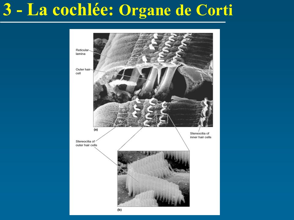 3 - La cochlée: Organe de Corti