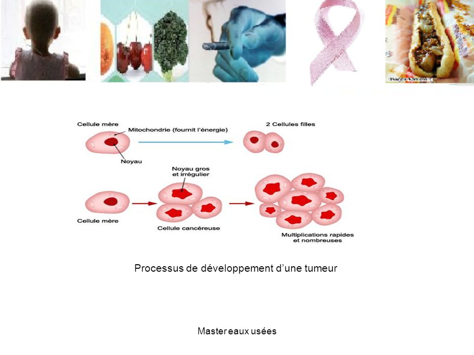 Processus de développement d’une tumeur