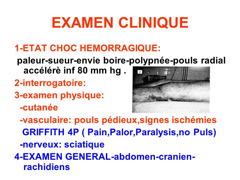 EXAMEN CLINIQUE 1-ETAT CHOC HEMORRAGIQUE: