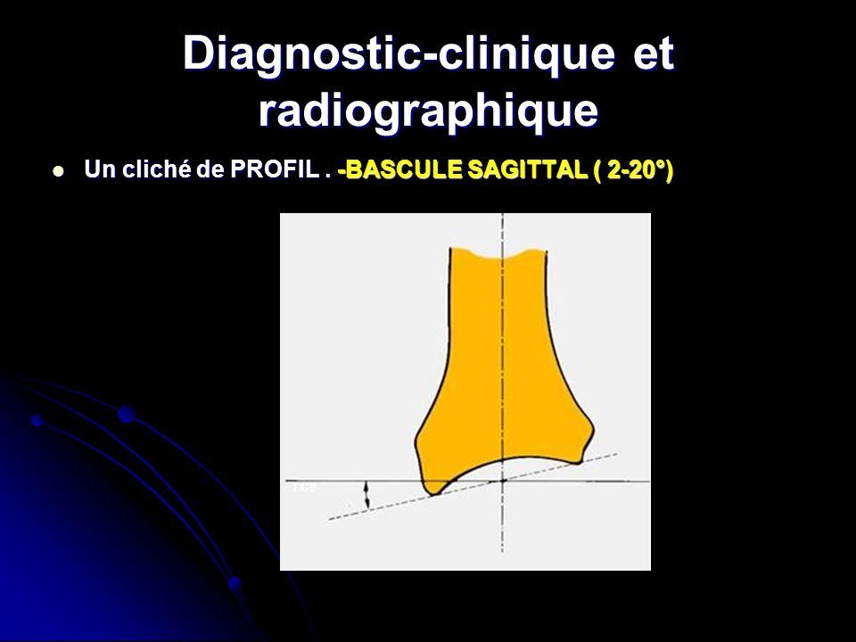 Diagnostic-clinique et radiographique