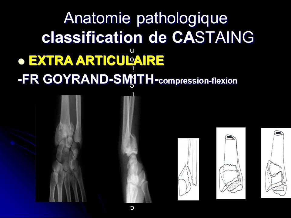 Anatomie pathologique classification de CASTAING