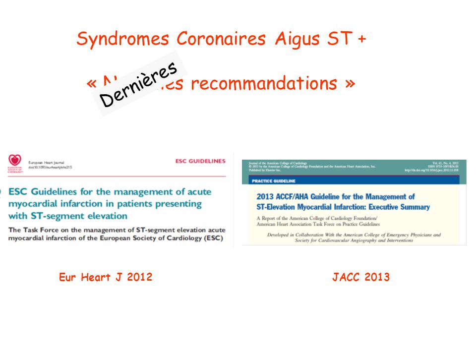 Syndromes Coronaires Aigus ST + « Nouvelles recommandations »