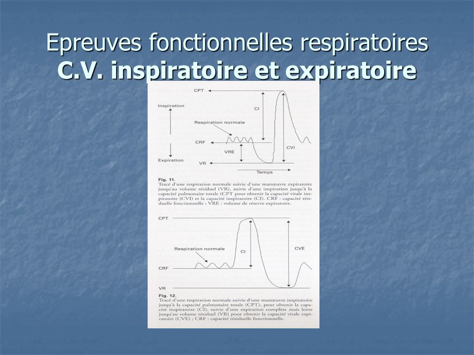 Epreuves fonctionnelles respiratoires C.V. inspiratoire et expiratoire