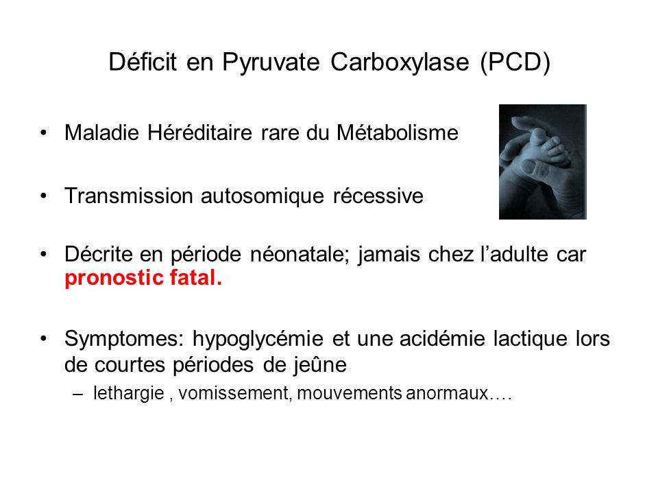 Déficit en Pyruvate Carboxylase (PCD)