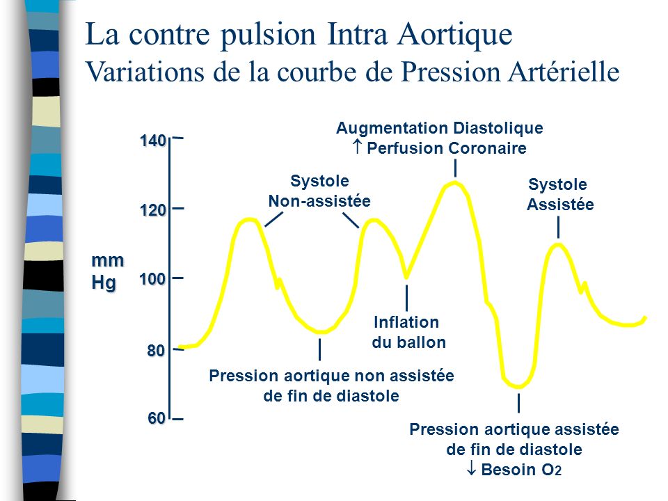 La contre pulsion Intra Aortique Variations de la courbe de Pression Artérielle