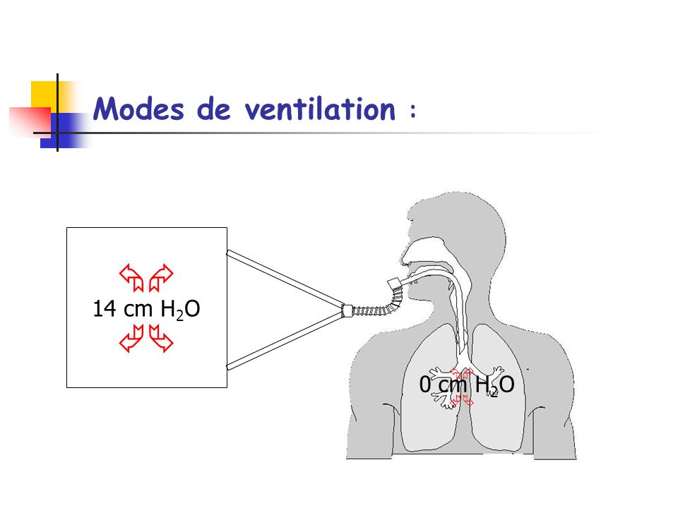 Modes de ventilation :   14 cm H2O   0 cm H2O