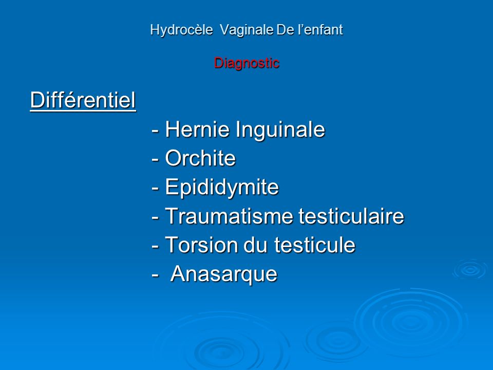 Hydrocèle Vaginale De l’enfant Diagnostic