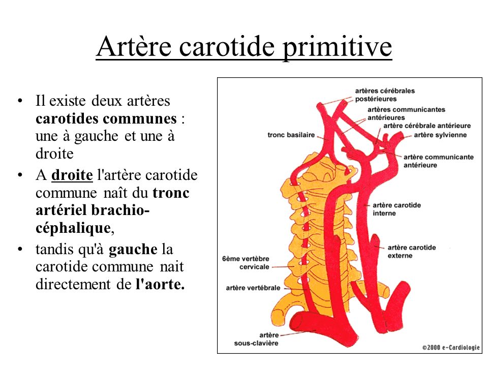 Artère carotide primitive