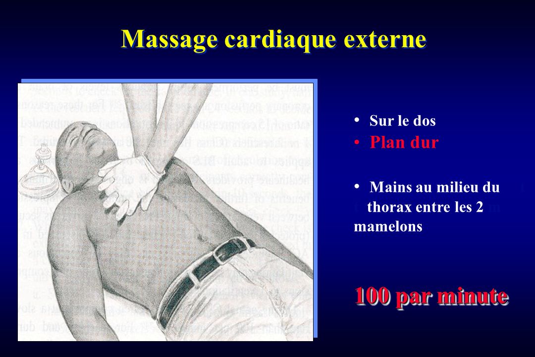Massage cardiaque externe