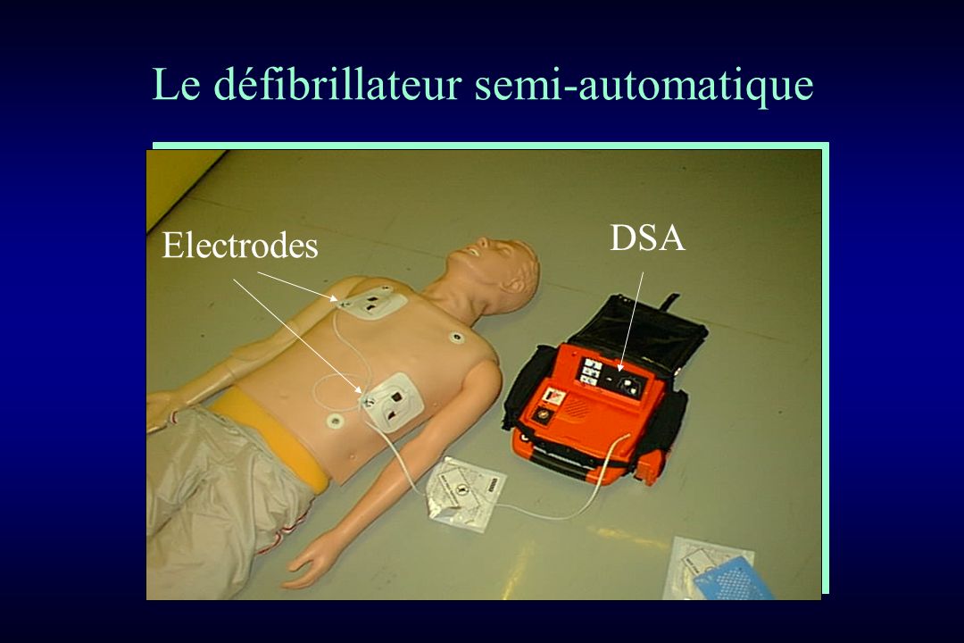 Le défibrillateur semi-automatique