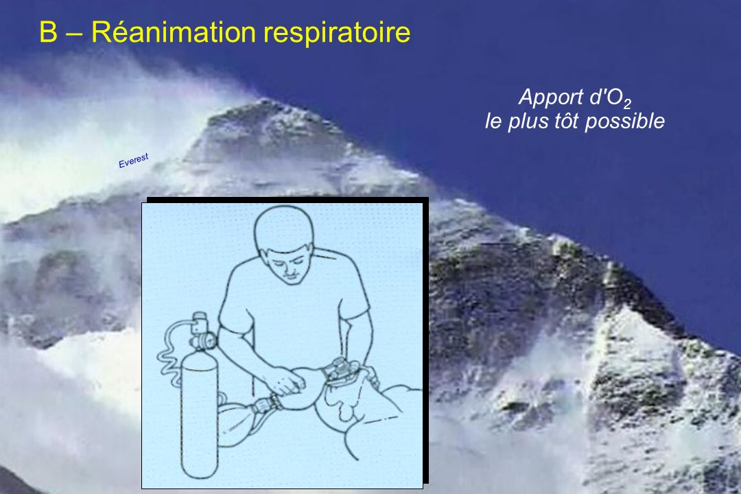 B – Réanimation respiratoire
