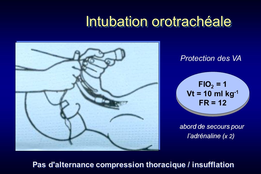 Pas d alternance compression thoracique / insufflation