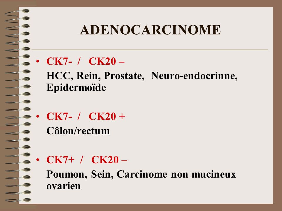 ADENOCARCINOME CK7- / CK20 –