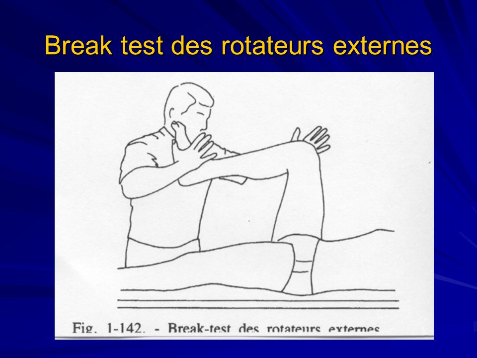 Break test des rotateurs externes