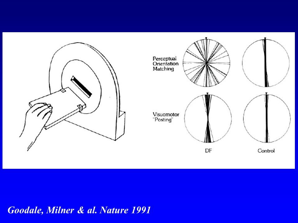 Goodale, Milner & al. Nature 1991