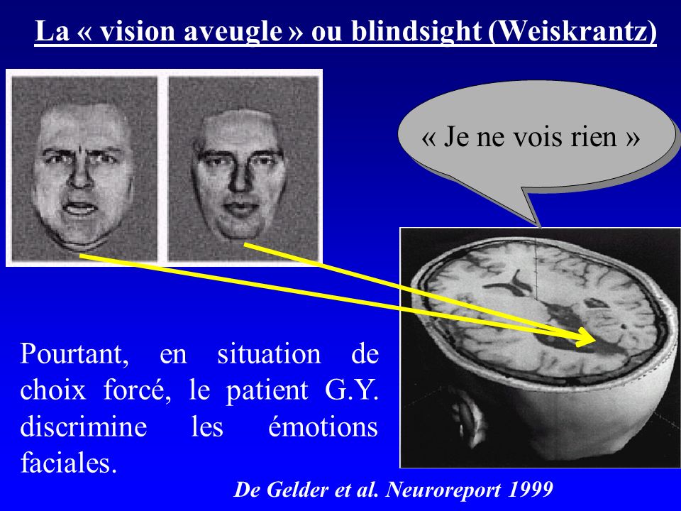 La « vision aveugle » ou blindsight (Weiskrantz)