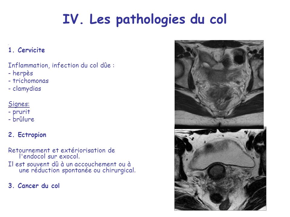 IV. Les pathologies du col