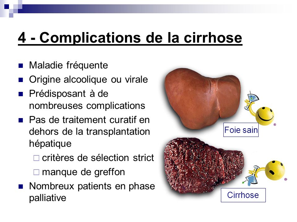4 - Complications de la cirrhose