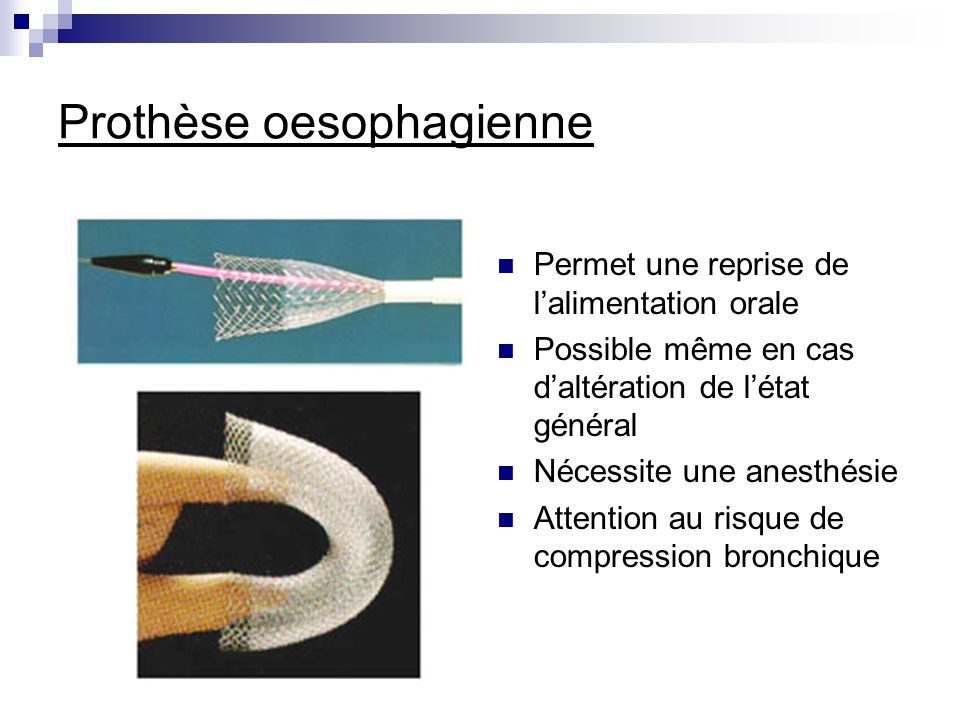 Prothèse oesophagienne