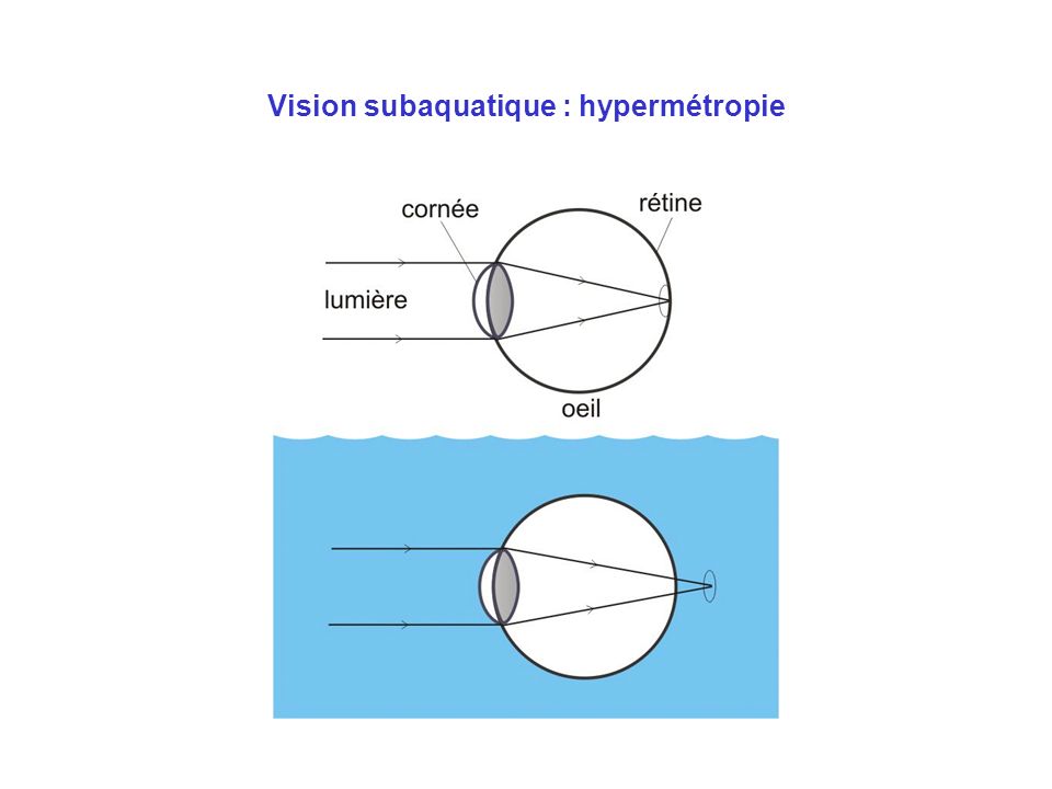 Vision subaquatique : hypermétropie