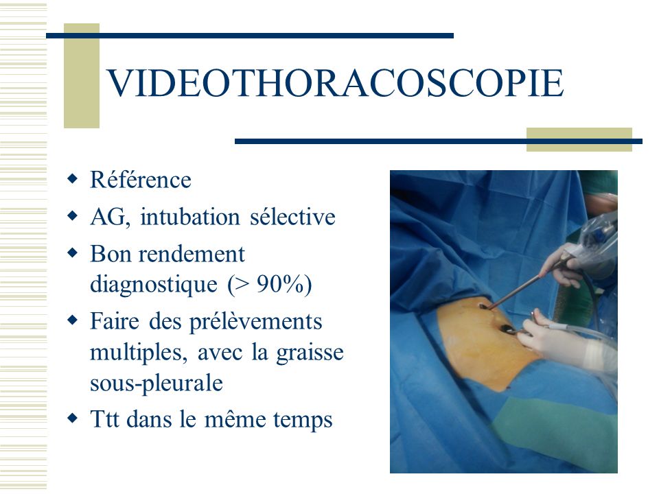 VIDEOTHORACOSCOPIE Référence AG, intubation sélective